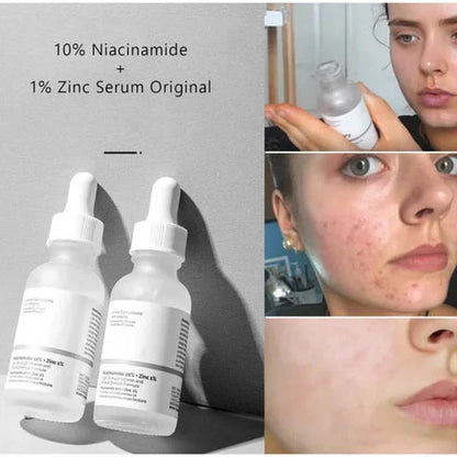 The Ordinary Niacinamide 10% + Zinc 1% Serum